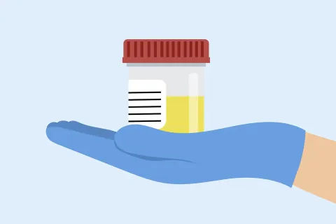 illustration of gloved hand holding urine sample in container