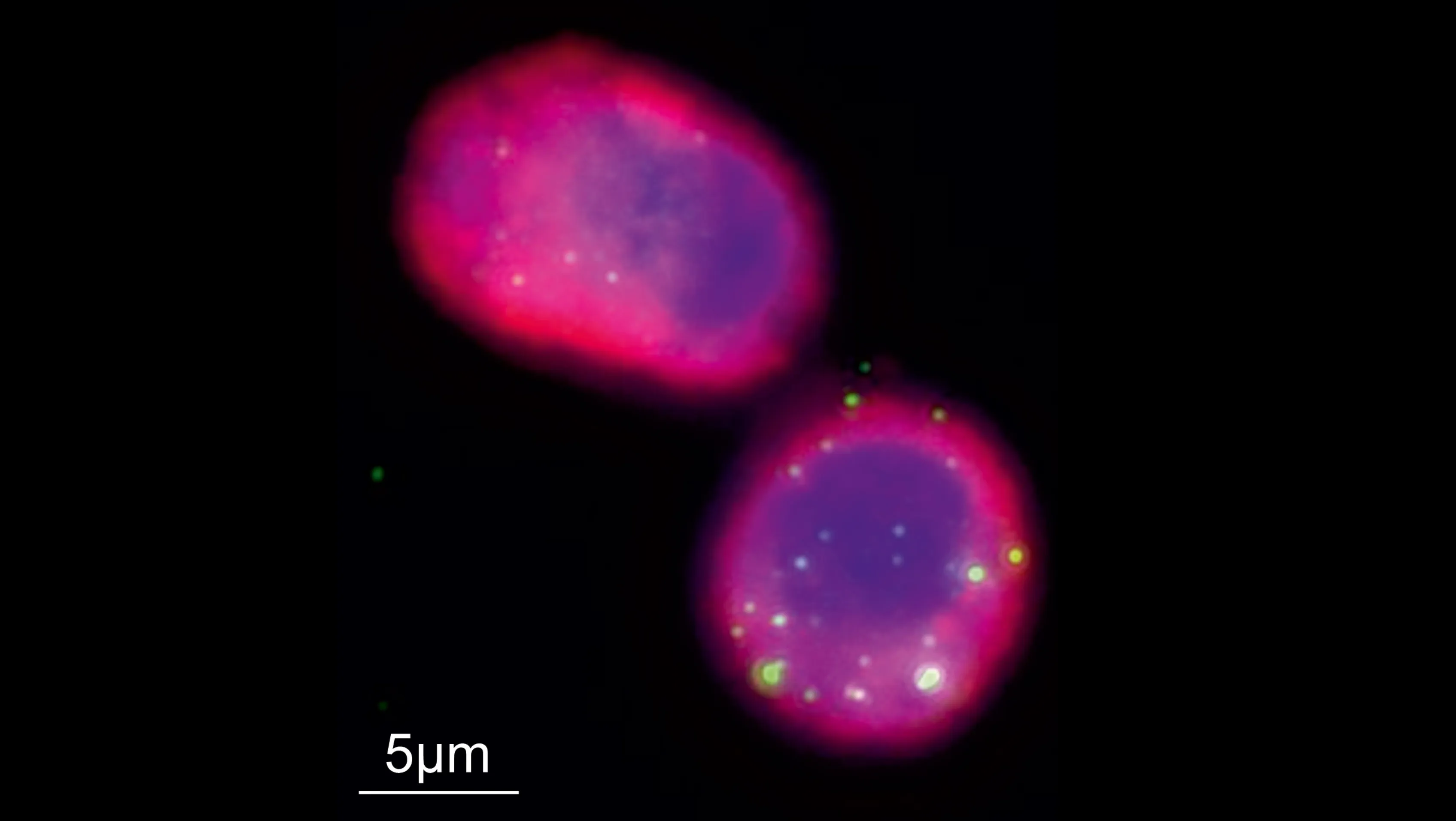 Phages (green) are shown engulfed by alveolar macrophages (cytoskeleton in pink and nucleus in blue). 